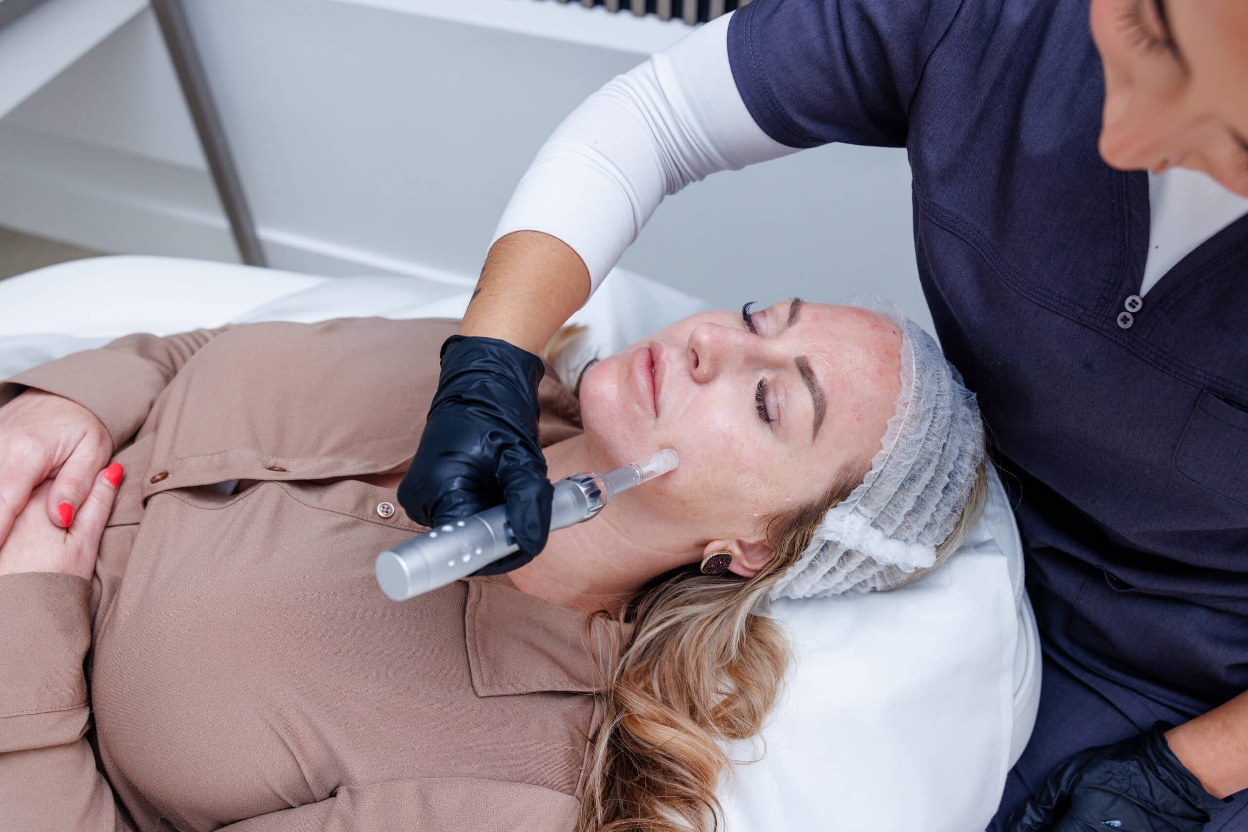 Why Everyone Loves Microneedling